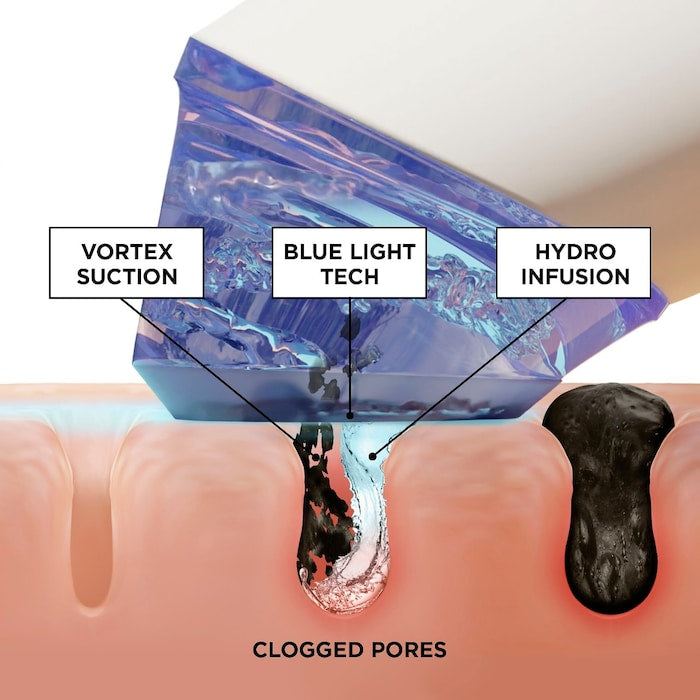 BeautyBio 
GLOfacial Hydro-Infusion Pore Cleansing + Blue LED Clarifying Tool